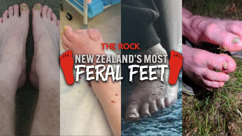 We've found New Zealand's most feral feet... definitely don't read this while you're eating